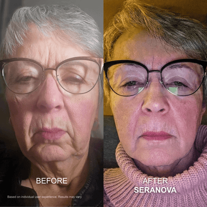 The Micro Infusion Syste