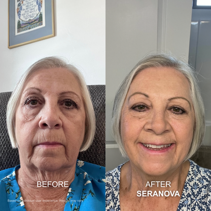 The Micro Infusion Syste