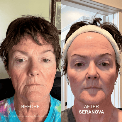 The Micro Infusion Syste